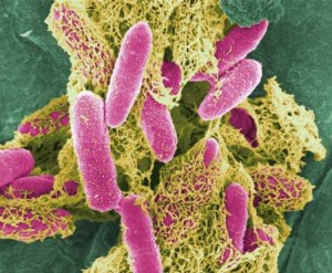 e-coli-bacteria