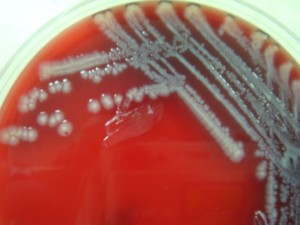 e-coli-bacteria7