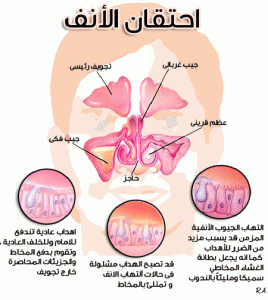 اعراض التهاب وحساسية الجيوب الانفية