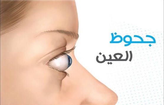 بروز العينين و زيارة طبيب العيون