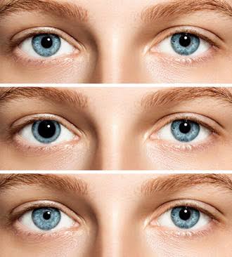 تغير حجم بؤبؤ العين و زيارة طبيب العيون  