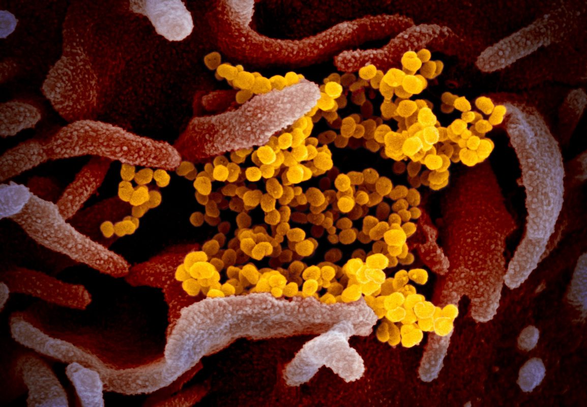 شكل فيروس كوفيد ١٩ تحت المجهر