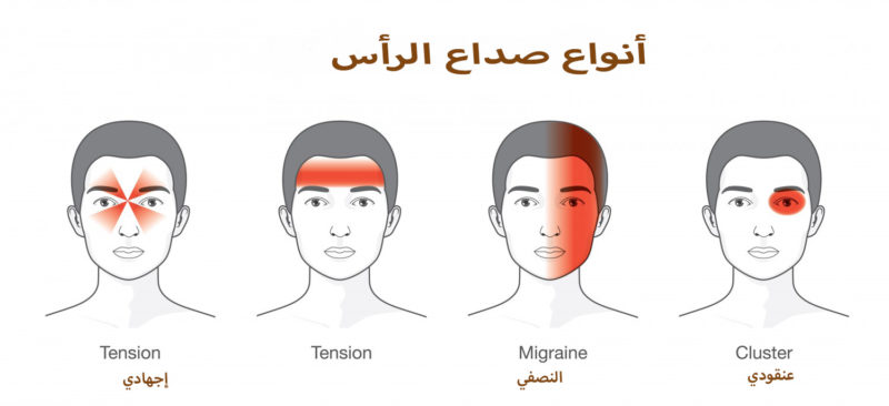 أنواع صداع الرأس