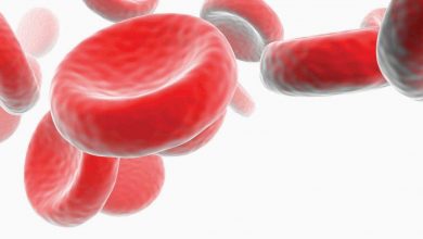 مرض فقر الدم ، أسباب وأعراض وعلاج فقر الدم